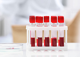 Комплексные анализы со скидкой в январе