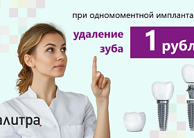Удаление зуба за 1 рубль при одномоментной имплантации