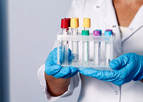 Скидка 10% на сдачу анализов в день их назначения в январе