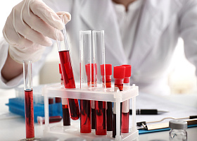 Комплексные анализы со скидкой в апреле